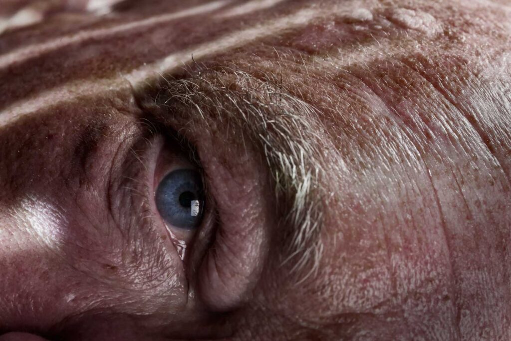 "Skinscapes" von J. Scriba: Foto-Aktion in der Hautklinik der Berliner Charité